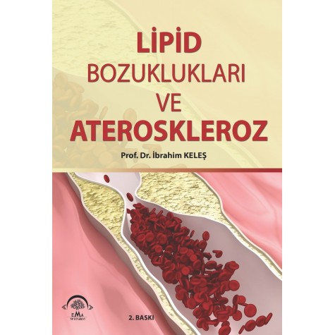 Lipid Bozuklukları ve Ateroskleroz